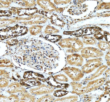 IHC staining of FFPE human kidney tissue with Calbindin antibody. HIER: boil tissue sections in pH8 EDTA for 20 min and allow to cool before testing.