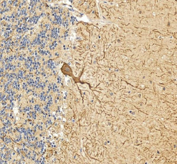 IHC staining of FFPE human cerebellum tissue with Calbindin antibody. HIER: boil tissue sections in pH8 EDTA for 20 min and allow to cool before testing.