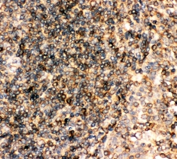 CD23 Antibody Rabbit Polyclonal Human Tonsil Immunohistochemistry. IHC-P: CD23 antibody testing of human tonsil tissue. HIER: steam section in pH6 citrate buffer for 20 min.