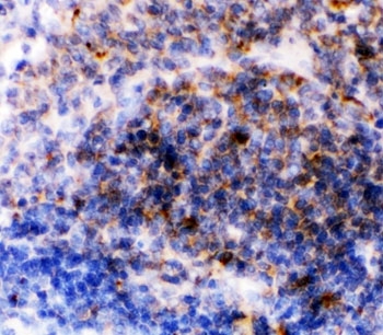 CD23 Antibody Rabbit Polyclonal Rat Spleen Immunohistochemistry. IHC-P: CD23 antibody testing of rat spleen tissue. HIER: steam section in pH6 citrate buffer for 20 min.