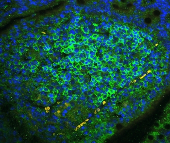 CD23 Antibody Rabbit Polyclonal Mouse Lymph Tissue IF. Immunofluorescence of CD23 antibody in FFPE mouse lymph tissue. The rabbit polyclonal CD23 antibody (green) demonstrates membranous staining of lymphoid cells within follicular areas, consistent with CD23 expression on B cell populations. Nuclei are counterstained with DAPI (blue). Heat-induced epitope retrieval was performed by steaming sections in pH 6 citrate buffer for 20 minutes prior to staining.