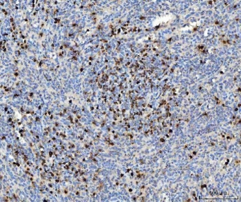 Myeloperoxidase (MPO) Antibody Human Spleen IHC. Immunohistochemistry staining of FFPE human spleen tissue using MPO Antibody demonstrates distinct granular cytoplasmic HRP-DAB brown staining within scattered myeloid lineage cells distributed throughout the splenic tissue. The staining pattern is consistent with expression of Myeloperoxidase (MPO), a heme-containing lysosomal enzyme abundantly expressed in neutrophils, granulocytic precursors, and other cells of myeloid origin. MPO functions in innate immune defense by catalyzing the formation of reactive oxidant species within phagolysosomes during antimicrobial responses. The observed distribution of positively stained cells is consistent with the known localization of MPO-expressing leukocytes within splenic immune compartments and supports the utility of MPO as a marker of myeloid differentiation and granulocytic lineage identification. HIER: boil tissue sections in pH 8 EDTA buffer for 20 minutes and allow to cool before testing.