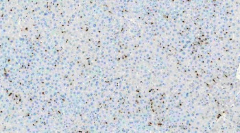 Myeloperoxidase (MPO) Antibody Mouse Liver IHC. Immunohistochemistry staining of FFPE mouse liver tissue using MPO Antibody demonstrates scattered granular cytoplasmic HRP-DAB brown staining within infiltrating myeloid cells distributed throughout the hepatic parenchyma. The staining pattern is consistent with expression of Myeloperoxidase (MPO), a heme-containing lysosomal enzyme characteristically expressed by neutrophils, granulocytes, and other cells of myeloid lineage. MPO-positive cells are observed against a largely negative hepatocellular background, highlighting resident or infiltrating inflammatory populations within the liver tissue. The observed distribution is consistent with the established use of MPO as a marker of granulocytic differentiation, innate immune responses, and myeloid cell identification in normal and inflamed tissues. HIER: heat-mediated antigen retrieval in pH 8.0 EDTA buffer prior to overnight primary antibody incubation and HRP-DAB chromogenic detection.