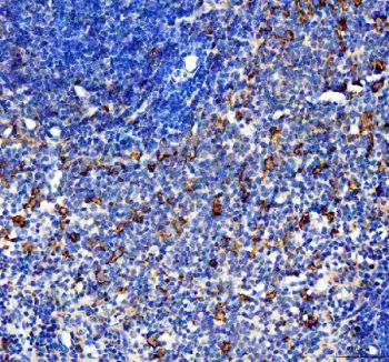 IHC staining of FFPE rat spleen tissue with CCL4 antibody. HIER: boil tissue sections in pH8 EDTA for 20 min and allow to cool before testing.