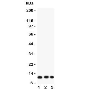 Eotaxin-3 Antibody Human Cancer Cell Lines WB. Western blot analysis of CCL26 expression was performed using anti-Eotaxin-3 antibody in lysates from human COLO320, A549, and HT1080 cells. Eotaxin-3, also known as CCL26, is a CC chemokine that mediates eosinophil recruitment and contributes to allergic inflammation and Th2 immune responses. Lane 1: COLO320 lysate. Lane 2: A549 lysate. Lane 3: HT1080 lysate. A specific immunoreactive band is detected at approximately 11 kDa in all three cell lines, corresponding to the predicted molecular weight of Eotaxin-3. Similar expression across colon carcinoma, lung carcinoma, and fibrosarcoma cells is consistent with the broad involvement of CCL26 in inflammatory signaling and tumor-associated immune responses. These results support the utility of Eotaxin-3 Antibody for studies of chemokine biology, eosinophil recruitment, and inflammatory disease.