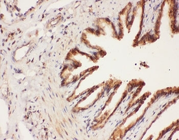 IHC-P: ALOX15 antibody testing of rat lung tissue