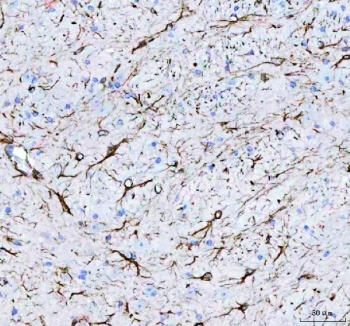 IHC staining of FFPE mouse brain tissue with GFAP antibody. HIER: boil tissue sections in pH8 EDTA for 20 min and allow to cool before testing.