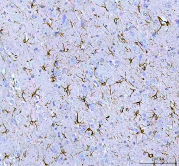 IHC staining of FFPE rat brain tissue with GFAP antibody. HIER: boil tissue sections in pH8 EDTA for 20 min and allow to cool before testing.