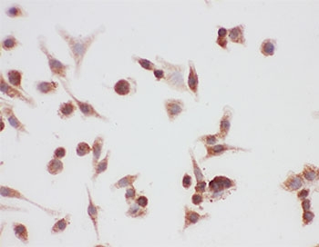 HSP90 alpha Antibody A549 ICC. Immunocytochemistry staining of human A549 cells using HSP90 alpha Antibody / Heat Shock Protein 90 Alpha Antibody demonstrates predominantly cytoplasmic immunoreactivity with weaker nuclear staining. The staining pattern is consistent with expression of HSP90 alpha (HSP90AA1), a highly conserved ATP-dependent molecular chaperone involved in protein folding, stabilization of client proteins, signal transduction, and cellular stress-response pathways. HSP90 alpha is primarily localized within the cytoplasm, where it supports proteostasis and maintains the functional stability of numerous signaling and regulatory proteins. The observed staining supports detection of HSP90 alpha expression in cultured human lung carcinoma cells by immunocytochemistry.