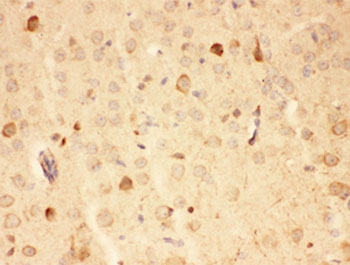 HSP90 alpha Antibody Mouse Brain IHC. Immunohistochemistry staining of FFPE mouse brain tissue using HSP90 alpha Antibody / Heat Shock Protein 90 Alpha Antibody demonstrates diffuse cytoplasmic HRP-DAB brown staining throughout neural tissue with scattered cells exhibiting stronger immunoreactivity. The staining pattern is consistent with expression of HSP90 alpha (HSP90AA1), a highly conserved ATP-dependent molecular chaperone that regulates protein folding, stabilization of client proteins, signal transduction, and cellular stress-response pathways. HSP90 alpha is abundantly expressed in neuronal and glial populations where it contributes to proteostasis, maintenance of cellular homeostasis, and protection against protein misfolding. HIER was performed by steaming tissue sections in pH 6 citrate buffer prior to immunostaining.