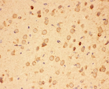 HSP90 alpha Antibody Rat Brain IHC. Immunohistochemistry staining of FFPE rat brain tissue using HSP90 alpha Antibody / Heat Shock Protein 90 Alpha Antibody demonstrates diffuse cytoplasmic HRP-DAB brown staining throughout neural tissue with prominent immunoreactivity in scattered neuronal cell populations. The staining pattern is consistent with expression of HSP90 alpha (HSP90AA1), a highly conserved ATP-dependent molecular chaperone involved in protein folding, stabilization of client proteins, signal transduction, and cellular stress-response pathways. HSP90 alpha plays an essential role in maintaining proteostasis and cellular homeostasis within the nervous system, where it supports the function and stability of numerous signaling and regulatory proteins. HIER was performed by steaming tissue sections in pH 6 citrate buffer prior to immunostaining.