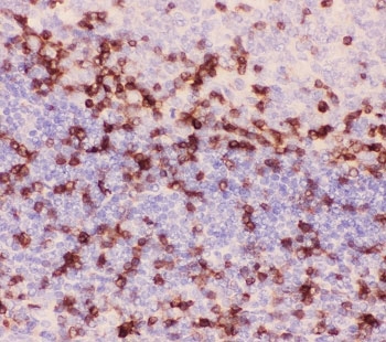 IHC-P: CD3 epsilon antibody testing of human tonsil tissue. Required HIER: steam section in pH6 citrate buffer for 20 min and allow to cool prior to testing.