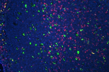 CD3 epsilon Antibody for IF. Immunofluorescence analysis of CD3 Epsilon / CD3E antibody in FFPE human tonsil tissue using a rabbit polyclonal CD3e Immunofluorescence Antibody. CD3-positive T lymphocytes are visualized as bright pink membrane-associated and cytoplasmic fluorescence, predominantly localized within interfollicular regions, consistent with T-cell zone distribution. CD68 monoclonal antibody (green) highlights macrophages within the tissue, while DAPI (blue) marks cell nuclei. The staining demonstrates clear spatial separation between T-cell and macrophage populations and enables visualization of immune cell organization within lymphoid architecture. Heat-induced epitope retrieval was performed by steaming tissue sections in pH 6 citrate buffer for 20 minutes prior to staining.