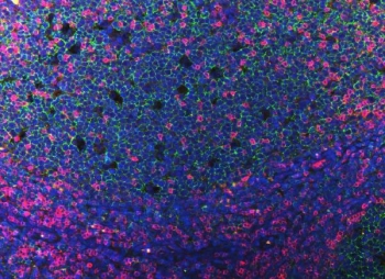 CD3 epsilon Antibody for IF. Immunofluorescence analysis of CD3 Epsilon / CD3E antibody in FFPE human tonsil tissue using a rabbit polyclonal CD3e Immunofluorescence Antibody. CD3-positive T lymphocytes are detected as bright pink membrane-associated and cytoplasmic fluorescence predominantly within interfollicular and paracortical regions, while CD20 monoclonal antibody (green) labels B cells within follicular structures. DAPI (blue) marks cell nuclei, providing clear architectural context. The staining highlights the spatial segregation of T-cell and B-cell compartments within tonsillar lymphoid tissue. Heat-induced epitope retrieval was performed by steaming tissue sections in pH 8 EDTA buffer for 20 minutes prior to staining.
