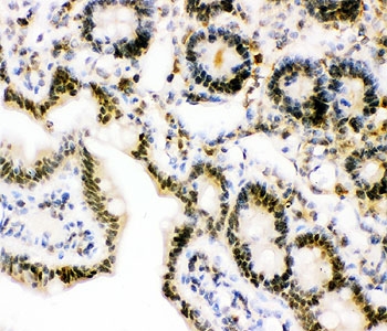 IHC-P: Ubiquitin antibody testing of rat intestine tissue
