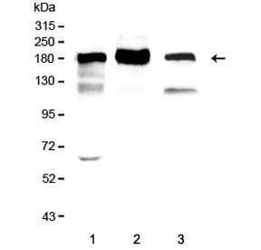 ACE Antibody Immunoblot. Western blot testing of 1) rat lung, 2) mouse lung and 3) Raji lysate with ACE antibody. Expected molecular weight 140-170+ kDa depending on glycosylation level.