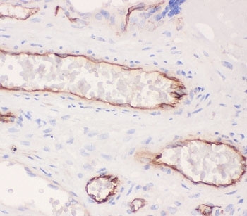ACE Antibody Placenta IHC. Immunohistochemistry of ACE antibody testing human placenta tissue. HIER: boil tissue sections in pH6, 10mM citrate buffer, for 20 min and allow to cool before testing.