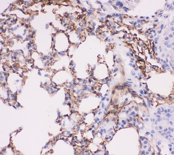ACE Antibody Mouse Lung IHC. Immunohistochemistry of ACE antibody testing mouse lung tissue. HIER: boil tissue sections in pH6, 10mM citrate buffer, for 20 min and allow to cool before testing.