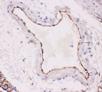ACE Antibody Rat Lung IHC. Immunohistochemistry of ACE antibody testing rat lung tissue with ACE antibody. HIER: boil tissue sections in pH6, 10mM citrate buffer, for 20 min and allow to cool before testing.