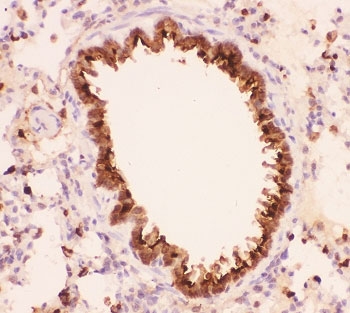 IHC-P: Annexin A1 antibody testing of rat lung tissue. HIER: boil tissue sections in pH8 EDTA for 20 min and allow to cool before testing.