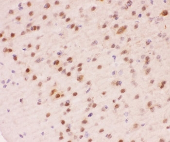 IHC-P staining of mouse brain tissue. HIER: steam section in pH6 citrate buffer for 20 min.