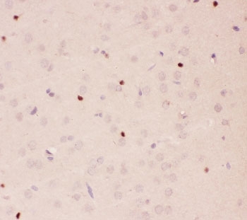 IHC-P staining of rat brain tissue. HIER: steam section in pH6 citrate buffer for 20 min.