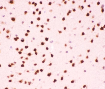 IHC testing of FFPE mouse brain tissue with ATF2 antibody at 1ug/ml. Required HIER: steam section in pH6 citrate buffer for 20 min and allow to cool prior to staining.