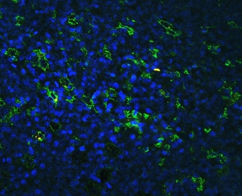Western blot testing of human 1) Jurkat and 2) HeLa cell lysate with LFA-1 antibody. Expected molecular weight: 85~95 kDa depending on glycosylation level.
