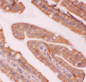 NFKB2 Antibody Mouse Intestine Tissue IHC. Immunohistochemistry staining of FFPE mouse intestine tissue with NFKB2 antibody. HIER: boil tissue sections in pH8 EDTA for 20 min and allow to cool before testing.