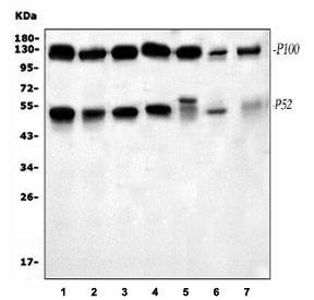 NFKB2 Antibody WB. Western blot testing of 1) human HeLa, 2) human Jurkat, 3) human MCF7, 4) human A549, 5) human U-87 MG, 6) mouse lung and 7) mouse RAW264.7 cell lysate with NFKB2 antibody.