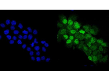 p63 Antibody for IF. Immunofluorescence analysis of FFPE human A431 cells using a rabbit polyclonal p63 antibody for IF demonstrates strong nuclear staining in TP63-positive cells (green), consistent with the role of Tumor protein 63 as a nuclear transcription factor. Signal is confined to the nucleus with minimal cytoplasmic background, allowing clear identification of TP63-expressing cells within the population. DAPI nuclear counterstain (blue) labels all nuclei, enabling direct comparison between positive and negative cells and highlighting cell-to-cell variability in TP63 expression. Heat-induced epitope retrieval was performed by steaming sections in pH 6 citrate buffer for 20 minutes prior to antibody incubation.