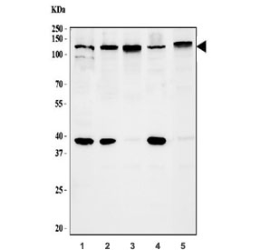 SIRT1 Antibody Human Cell Line WB. Western blot testing of human 1) HepG2, 2) MCF7, 3) SiHA, 4) Daudi and 5) K562 cell lysate with SIRT1 antibody. Expected molecular weight: 82-120 kDa depending on glycosylation level.