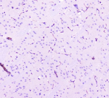 IHC staining of FFPE mouse brain tissue with Caveolin-1 antibody. HIER: boil tissue sections in pH8 EDTA for 20 min and allow to cool before testing.