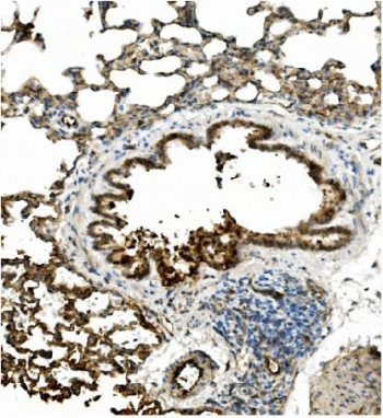 IHC staining of FFPE rat lung with Caveolin-2 antibody. HIER: boil tissue sections in pH8 EDTA for 20 min and allow to cool before testing.