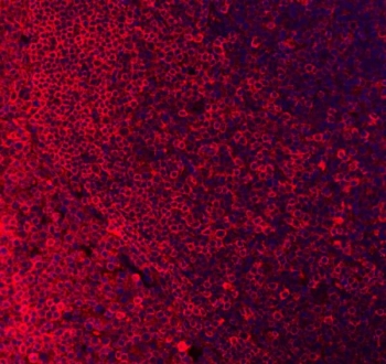Immunofluorescent staining of FFPE human tonsil tissue with CD79a antibody (red) and DAPI nuclear stain (blue). HIER: boil tissue sections in pH8 EDTA for 20 min and allow to cool before testing.
