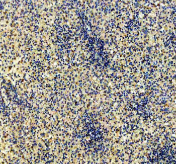 IHC staining of FFPE human spleen tissue with CD79b antibody, HRP-secondary and DAB substrate. HIER: boil tissue sections in pH8 EDTA for 20 min and allow to cool before testing.