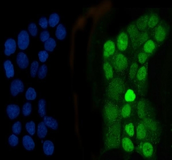 Immunofluorescent staining of FFPE human A431 cells with C/EBP beta antibody (green) and DAPI nuclear stain (blue). HIER: steam section in pH6 citrate buffer for 20 min.