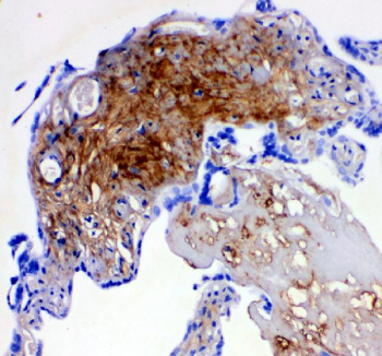 IHC analysis of Decorin Antibody / DCN. Decorin staining is observed in a paraffin-embedded section of human placenta tissue, with signal distributed throughout the extracellular matrix and stromal regions. Heat-mediated antigen retrieval was performed using EDTA buffer (pH 8.0). Tissue sections were blocked with 10% goat serum and incubated overnight at 4Â°C with rabbit anti-Decorin antibody, followed by a peroxidase-conjugated goat anti-rabbit IgG secondary antibody. Signal was developed using DAB chromogen, with hematoxylin used for nuclear counterstaining.