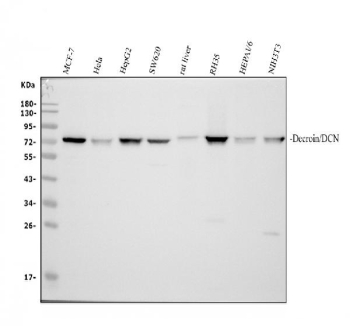 Western blot analysis of Decorin Antibody / DCN. Proteins were separated on a 10% SDS-PAGE gel under reducing conditions and transferred to a nitrocellulose membrane. Lane 1: human MCF-7 whole cell lysates; Lane 2: human HeLa whole cell lysates; Lane 3: human HepG2 whole cell lysates; Lane 4: human SW620 whole cell lysates; Lane 5: rat liver tissue lysates; Lane 6: rat RH35 whole cell lysates; Lane 7: mouse Hepa1-6 whole cell lysates; Lane 8: mouse NIH/3T3 whole cell lysates. A predominant band is observed at approximately 72 kDa, which is higher than the predicted molecular weight of Decorin (~40 kDa) and is consistent with the known proteoglycan nature of Decorin, including extensive glycosylation and glycosaminoglycan chain modification that cause slower migration on SDS-PAGE.