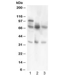 Western blot testing of GAD67 antibody and Lane 1:  rat testis;  2: mouse brain;  3: human MCF7 lysate.  Predicted/observed molecular weight ~67 kDa