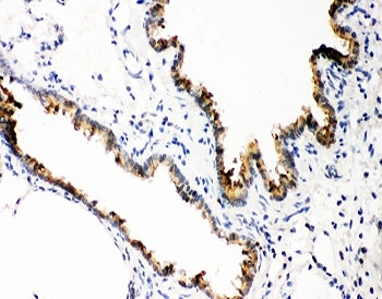 IHC-P: GSTP1 antibody testing of rat lung tissue. HIER: boil tissue sections in pH8 EDTA for 20 min and allow to cool before testing.