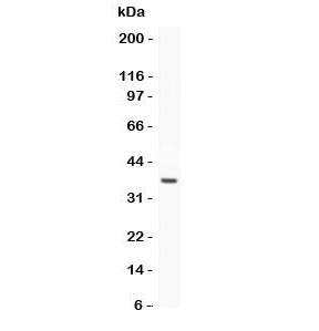 Western blot testing of Estrogen Receptor antibody and recombinant human protein (0.5ng)