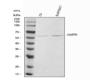G6PD Antibody Mouse and Rat WB. Western blot analysis of G6PD Antibody using lysates from lane 1: rat C6 cells and lane 2: mouse RAW264.7 cells. A specific band is detected at approximately 59 kDa in both samples, consistent with the predicted molecular weight of endogenous G6PD. These results demonstrate cross-species recognition of G6PD and support the use of G6PD Antibody, a Pentose Phosphate Pathway Enzyme Antibody, for studies of cellular metabolism, NADPH production and redox regulation in rodent models.