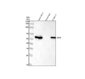 G6PD Antibody Human MCF-7 IP. Immunoprecipitation of endogenous G6PD from MCF-7 human breast cancer cell lysate using G6PD Antibody, followed by Western blot detection with the same antibody. Lane 1: MCF-7 input lysate, lane 2: rabbit IgG negative control immunoprecipitation, and lane 3: G6PD immunoprecipitation. A specific band is detected at approximately 59 kDa in the input and G6PD immunoprecipitate, while no corresponding band is observed in the IgG control, demonstrating specific enrichment of endogenous G6PD. This result supports the use of G6PD Antibody, a Pentose Phosphate Pathway Enzyme Antibody, for immunoprecipitation and studies of G6PD-associated metabolic pathways.