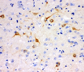 IHC-P testing of rat brain tissue. HIER: steam section in pH6 citrate buffer for 20 min.