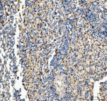 IHC staining of FFPE human spleen tissue with CD63 antibody. HIER: boil tissue sections in pH8 EDTA for 20 min and allow to cool before testing.