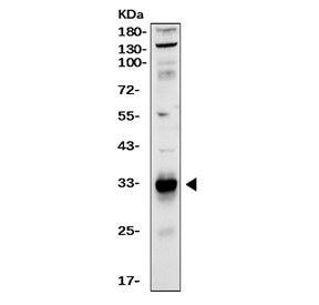 Western blot testing of human LNCaP cell lysate with PSA antibody. Expected molecular weight: 30~34 kDa.