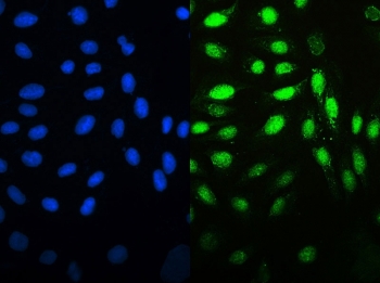 MCM7 Antibody for IF - immunofluorescence staining of human U-2 OS cells. FFPE human U-2 OS cells were stained with MCM7 Antibody for IF using a rabbit polyclonal antibody targeting Minichromosome maintenance complex component 7 / MCM7 (green). The signal localizes predominantly to cell nuclei, consistent with the known nuclear role of this DNA replication licensing factor. DAPI nuclear counterstain highlights cell nuclei (blue), demonstrating strong overlap with MCM7 staining in actively proliferating cells. Heat-induced epitope retrieval was performed by steaming sections in pH6 citrate buffer for 20 minutes prior to staining.