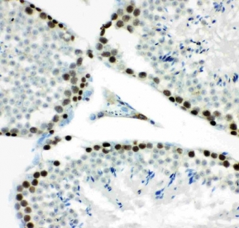 MCM7 Antibody Mouse Testis IHC. Immunohistochemistry staining of FFPE mouse testis tissue with MCM7 antibody. HIER: boil tissue sections in pH8 EDTA for 20 min and allow to cool before testing.