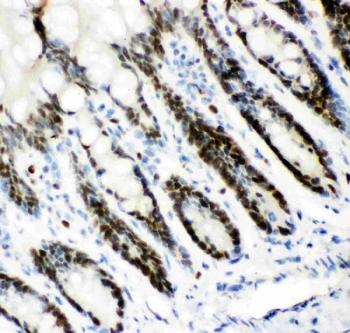 MCM7 Antibody Rat Intestine IHC. Immunohistochemistry staining of FFPE rat intestinal tissue with MCM7 antibody. HIER: boil tissue sections in pH8 EDTA for 20 min and allow to cool before testing.